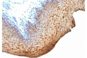 Formalin-fixed, paraffin-embedded human tonsil stained with Cytokeratin 10 + 13 antibody (DE-K13) (Keratin 10/13 抗体)