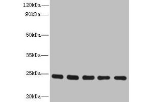 Western blot All lanes: RAB6B antibody at 5 μg/mL Lane 1: Mouse brain tissue Lane 2: U251 whole cell lysate Lane 3: MCF-7 whole cell lysate Lane 4: A549 whole cell lysate Lane 5: K562 whole cell lysate Secondary Goat polyclonal to rabbit IgG at 1/10000 dilution Predicted band size: 24, 23 kDa Observed band size: 24 kDa (RAB6B 抗体  (AA 2-208))