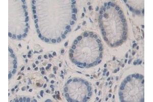 Immunohistochemistry (IHC) image for anti-Bone Morphogenetic Protein 15 (BMP15) (AA 266-388) antibody (ABIN7434677)