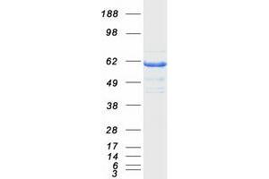 Validation with Western Blot (RIC8A Protein (Myc-DYKDDDDK Tag))
