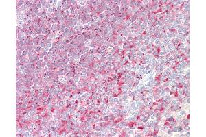 Anti-D52 / TPD52 antibody IHC staining of human spleen. (TPD52 抗体  (AA 213-223))