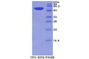 SDS-PAGE (SDS) image for Thrombospondin 2 (THBS2) (AA 968-1170) protein (His tag,GST tag) (ABIN2123655)