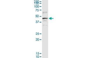 SERPINB2 MaxPab rabbit polyclonal antibody. (SERPINB2 抗体  (AA 1-415))
