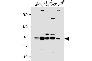 Western Blotting (WB) image for anti-Phosphoinositide 3 Kinase, p85 alpha (PI3K p85a) (AA 1-30), (N-Term) antibody (ABIN392570)