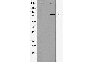 Western blot analysis of nNOS expression in HeLa cells,The lane on the left is treated with the antigen-specific peptide. (NOS1 抗体  (Internal Region))