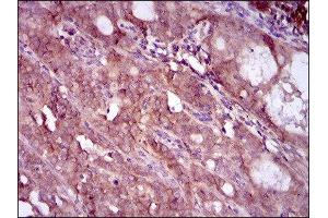 Immunohistochemistry (IHC) image for anti-EGFR Mutant (AA 693-893), (Mutant) antibody (ABIN1845729) (EGFR Mutant (AA 693-893), (Mutant) 抗体)