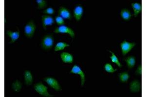 Immunofluorescence (IF) image for anti-Cyclin D3 (CCND3) (AA 1-292) antibody (ABIN7153394)