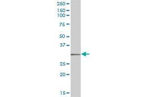 Western Blotting (WB) image for anti-Sulfotransferase Family, Cytosolic, 1C, Member 2 (SULT1C2) (AA 1-296) antibody (ABIN520613)