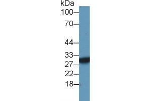 Western Blotting (WB) image for anti-Succinate Dehydrogenase Complex, Subunit B, Iron Sulfur (Ip) (SDHB) (AA 97-282) antibody (ABIN7441589)