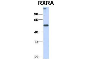 Host:  Rabbit  Target Name:  RXRA  Sample Type:  Human Fetal Heart  Antibody Dilution:  1. (Retinoid X Receptor alpha 抗体  (N-Term))