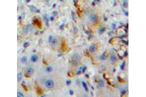 Used in DAB staining on fromalin fixed paraffin-embedded Liver tissue (Fc gamma RII (CD32) (AA 47-285) 抗体)