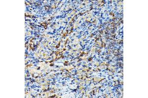 Immunohistochemistry of paraffin-embedded mouse spleen using PRC1 Rabbit pAb (ABIN6128502, ABIN6146124, ABIN6146125 and ABIN6222808) at dilution of 1:100 (40x lens). (PRC1 抗体  (AA 351-620))