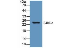 Detection of Recombinant Slit1, Rat using Polyclonal Antibody to Slit Homolog 1 (Slit1) (SLIT1 抗体  (AA 308-512))
