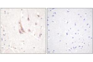 Immunohistochemistry analysis of paraffin-embedded human brain tissue, using PKC zeta (Ab-560) Antibody. (PKC zeta 抗体  (AA 526-575))