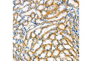 Immunohistochemistry (Paraffin-embedded Sections) (IHC (p)) image for anti-ATPase, H+/K+ Transporting, Nongastric, alpha Polypeptide (ATP12A) antibody (ABIN7073160)