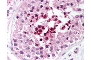 Image no. 2 for anti-Telomeric Repeat Binding Factor 2, Interacting Protein (TERF2IP) (AA 2406-2419) antibody (ABIN302914) (RAP1 抗体  (AA 2406-2419))