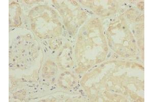 Immunohistochemistry of paraffin-embedded human kidney tissue using ABIN7150009 at dilution of 1:100 (ATPBD4 抗体  (AA 8-267))