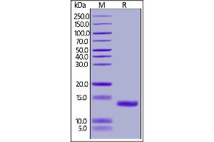 Mouse C5a, His Tag on  under reducing (R) condition. (C5A Protein (AA 679-755) (His tag))