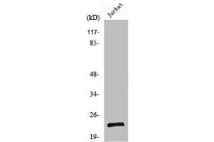 Western Blot analysis of Jurkat cells using Musculin Polyclonal Antibody (Musculin 抗体  (C-Term))