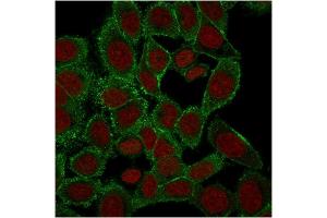 Immunofluorescence Analysis of PFA-fixed HeLa cells labeling with Moesin Mouse Monoclonal Antibody (rMSN/492) followed by Goat anti-Mouse IgG-CF488 (Green). (Recombinant Moesin 抗体)