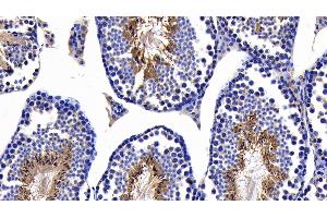 Detection of CASP8 in Mouse Testis Tissue using Polyclonal Antibody to Caspase 8 (CASP8) (Caspase 8 抗体  (AA 219-376))