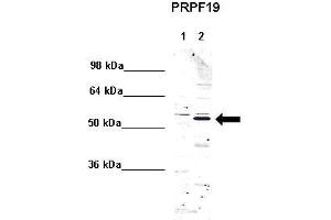 WB Suggested Anti-PRPF19 Antibody    Positive Control:  Lane 1: 5ug mouse brain cytoplasm Lane 2: 5ug mouse brain nucleus   Primary Antibody Dilution :   1:1000  Secondary Antibody :  Anti rabbit - IR-dye  Secondry Antibody Dilution :   1:10,000   Submitted by:  Anonymous (PRP19 抗体  (Middle Region))
