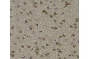 Immunohistochemistry of paraffin-embedded Mouse brain using PAWR Polyclonal Antibody at dilution of 1:200 (40x lens). (PAWR 抗体)