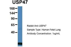 Host: Rabbit  Target Name: USP47  Sample Tissue: Human Fetal Lung  Antibody Dilution: 1. (USP47 抗体  (Middle Region))