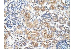 Image no. 1 for anti-AU RNA Binding Protein/enoyl-CoA Hydratase (AUH) (AA 228-277) antibody (ABIN6736199) (AUH 抗体  (AA 228-277))