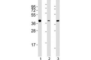 Western blot testing of ERCC1 antibody at 1:2000 dilution. (ERCC1 抗体  (AA 268-297))