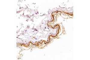 Immunohistochemistry of paraffin embedded mouse skin using TR2IT1 (ABIN7075887) at dilution of 1:1500 (400x lens) (TXNRD3NB 抗体)