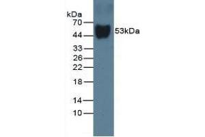 Detection of DBP in Rat Serum using Monoclonal Antibody to Vitamin D Binding Protein (DBP) (Vitamin D-Binding Protein 抗体  (AA 209-394))