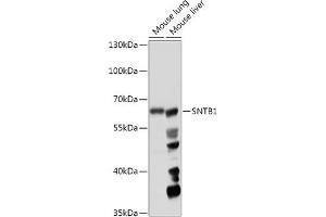 Western Blotting (WB) image for anti-Syntrophin, beta 1 (Dystrophin-Associated Protein A1, 59kDa, Basic Component 1) (SNTB1) (AA 1-110) antibody (ABIN7270693)