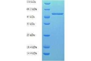 Fasciclin Arabinogalactan Protein 1 (FLA1) (AA 1-336), (full length) protein (His-SUMO Tag)
