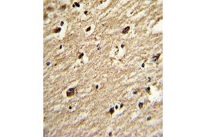 Immunohistochemistry (Paraffin-embedded Sections) (IHC (p)) image for anti-Protein Inhibitor of Activated STAT, 4 (PIAS4) (AA 471-499), (C-Term) antibody (ABIN388062)