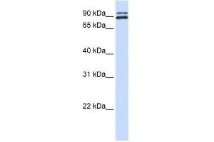 Western Blotting (WB) image for anti-Proprotein Convertase Subtilisin/kexin Type 6 (PCSK6) (N-Term) antibody (ABIN929014)
