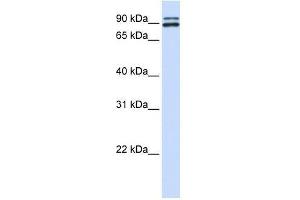 PCSK6 antibody used at 0. (PCSK6 抗体  (N-Term))