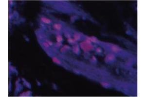 Immunofluorescence image ofTlP 39 staining in paraffn section of human trachea. (Parathyroid Hormone 2 (PTH2) 抗体)