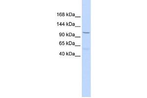 PCDH8 antibody used at 1 ug/ml to detect target protein. (Protocadherin 8 抗体  (Middle Region))