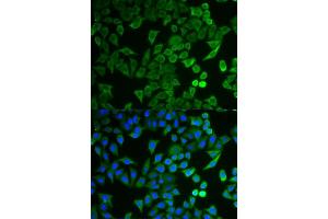 Immunofluorescence analysis of HeLa cells using NPRL2 antibody (ABIN6132809, ABIN6144787, ABIN6144788 and ABIN6221564). (NPRL2 抗体  (AA 1-220))