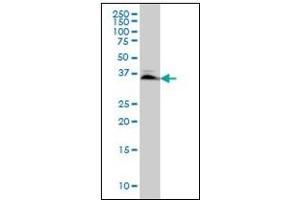 Western Blotting (WB) image for anti-SMAD, Mothers Against DPP Homolog 3 (SMAD3) antibody (ABIN781908)
