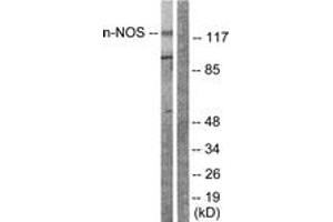 Western blot analysis of extracts from Raw264. (NOS1 抗体  (AA 818-867))