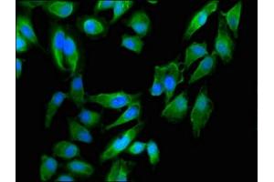 Immunofluorescent analysis of Hela cells using ABIN7150926 at dilution of 1:100 and Alexa Fluor 488-congugated AffiniPure Goat Anti-Rabbit IgG(H+L) (Dystonin 抗体  (AA 1-195))