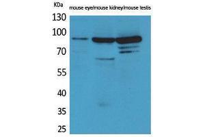 Western Blotting (WB) image for anti-HRS (HRS) (Internal Region) antibody (ABIN3180991) (HRS (HRS) (Internal Region) 抗体)