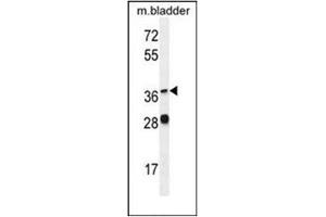 Western blot analysis of FADS6 Antibody (FADS6 抗体  (C-Term))