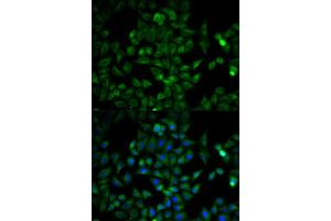Immunofluorescence analysis of HeLa cells using TPI1 antibody. (TPI1 抗体)