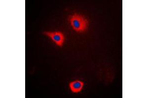 Immunofluorescent analysis of Cytochrome P450 2U1 staining in LOVO cells. (CYP2U1 抗体  (Center))