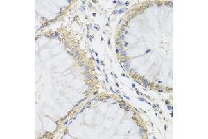 Immunohistochemistry of paraffin-embedded human colon using MTX1 antibody at dilution of 1:100 (x40 lens). (Metaxin 1 抗体)