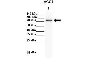 Western Blotting (WB) image for anti-Aconitase 1 (ACO1) (N-Term) antibody (ABIN2778793)