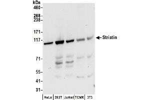 anti-Striatin (STRN) (AA 250-300) antibody